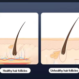 Comparison of health benefits with and without hair growth device.