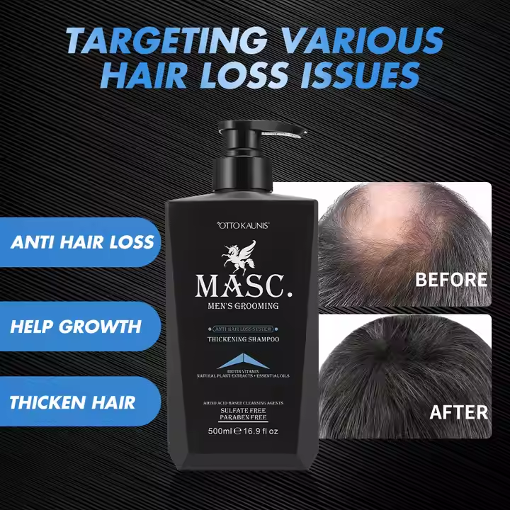 Shampoo targeting various hair loss and scalp issues.