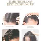 VariousHairproblems illustrating common hair issues and solutions